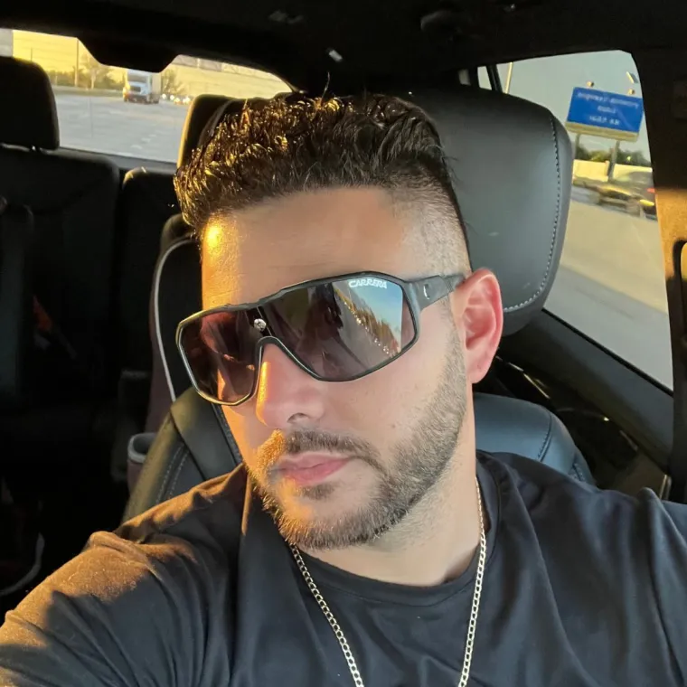 Restauración capilar súper completa, después, de viaje, Hair Transplant Design Tampa